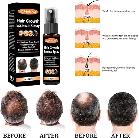 Hair Regrowth Spray – Anti Hair Loss & Hair Growth Solution