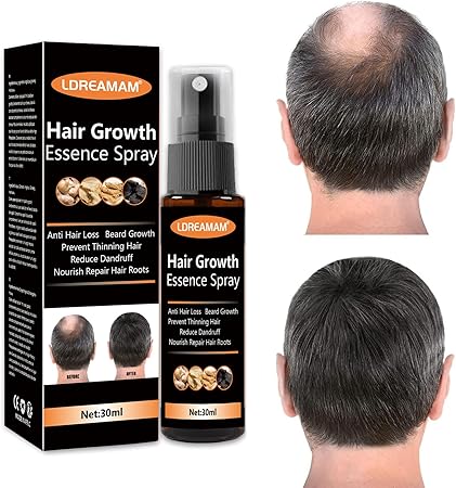 Hair Regrowth Spray – Anti Hair Loss & Hair Growth Solution