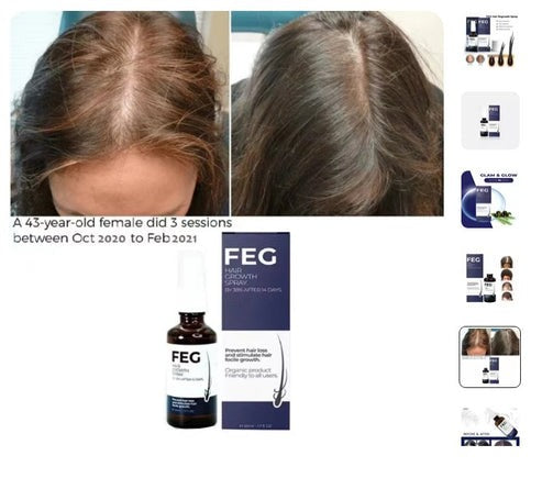 FEG Hair Growth Spray – Anti Hair Loss & Hair Regrowth Treatment