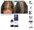 FEG Hair Growth Spray – Anti Hair Loss & Hair Regrowth Treatment