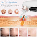 Electric Blackhead Remover – Deep Pore Acne Vacuum